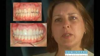 LumiSmile Patient Testimonials