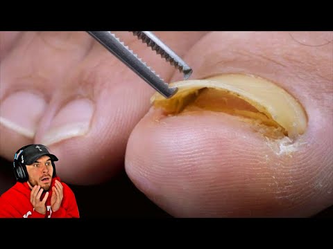 nur 0,01% können dieses Video ganz schauen...