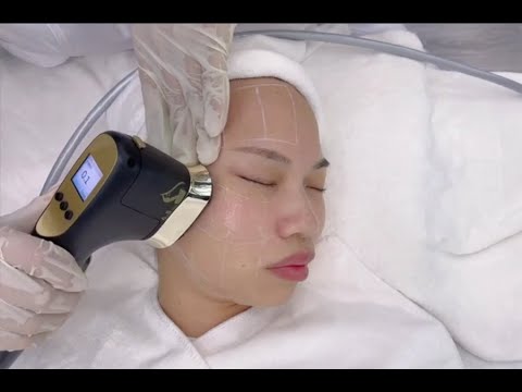 22d hifu facial treatment hifu abdomen treatment