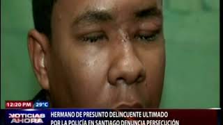 Joven perdió la vista tras ataque a palos en Santiago