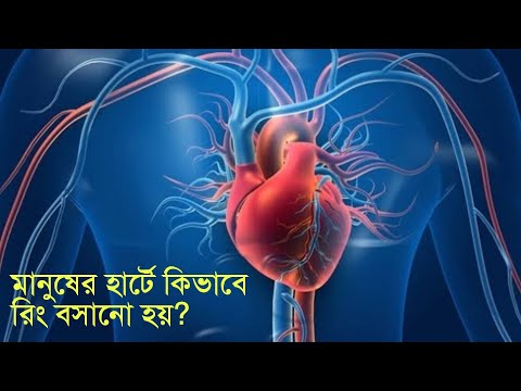 How to set Ring in Heart? [Nazsan Shuvo]