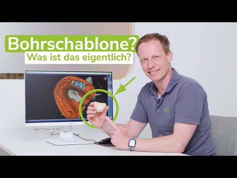 Bohrschablone - Was ist das eigentlich? | Dr. Frank-Ch. Langer - m71 Sankt Augustin