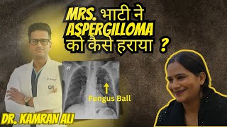 Aspergilloma Lung - Treatment