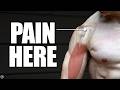 Biceps Tendinopathy / Tendinitis | Anterior Shoulder Pain Rehab (Education & Exercises)