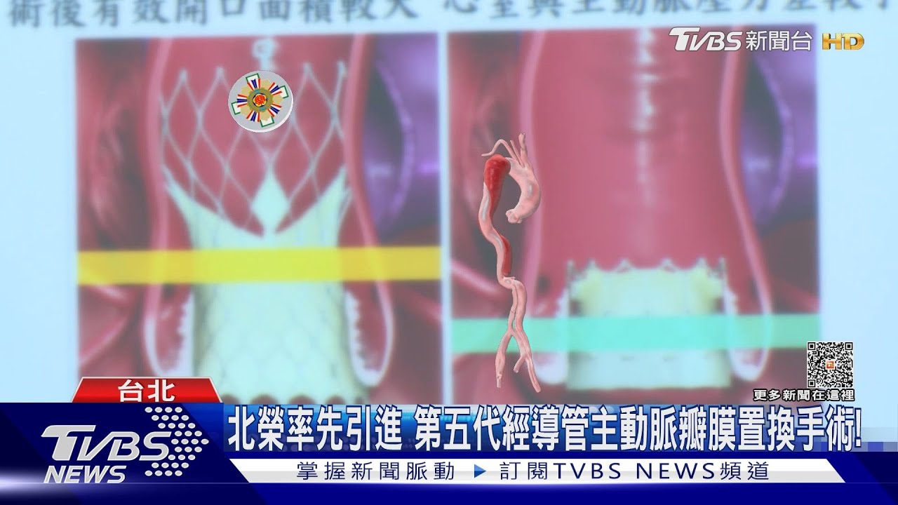 勿疏忽「這件事」!又冒出「這些症狀」醫師:致死風險高