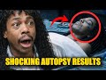 Rick James’ Autopsy Uncovers Chilling Secrets — What Really Happened That Night?
