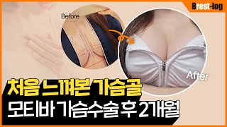 윈느성형외과 유튜브 영상 썸네일