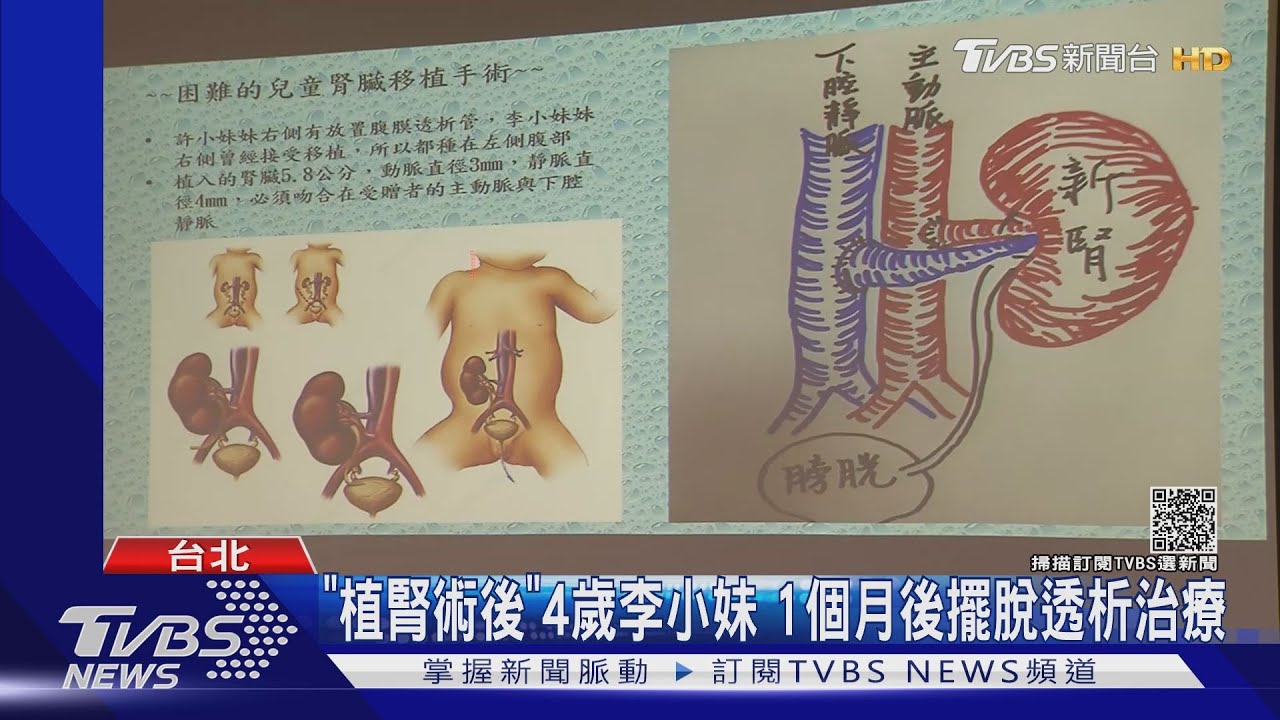 台「最低體重」器捐紀錄!1歲嬰「捐雙腎」救2童