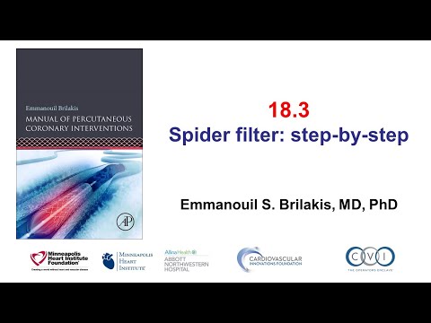 18.3 Spider filter: step-by-step - Manual of PCI