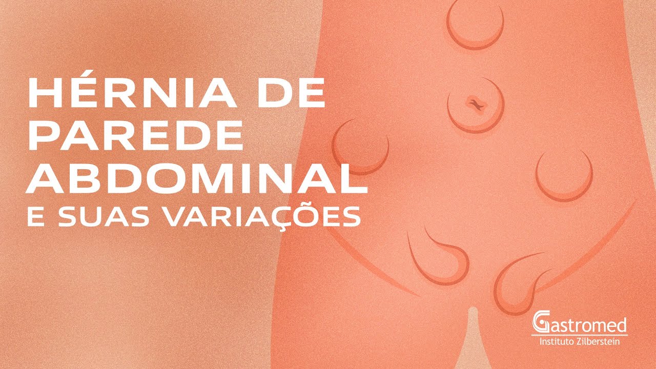 hérnia de parede abdominal - tipos e tratamento cirúrgico