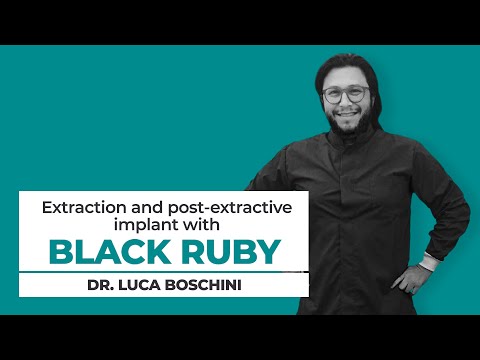 Clinical case — Black Ruby implant site preparation in real practice