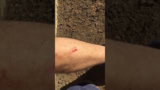 When Wombats attack!!!