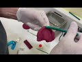 Demonstration Of Kemdent Green Stick Impression Compound