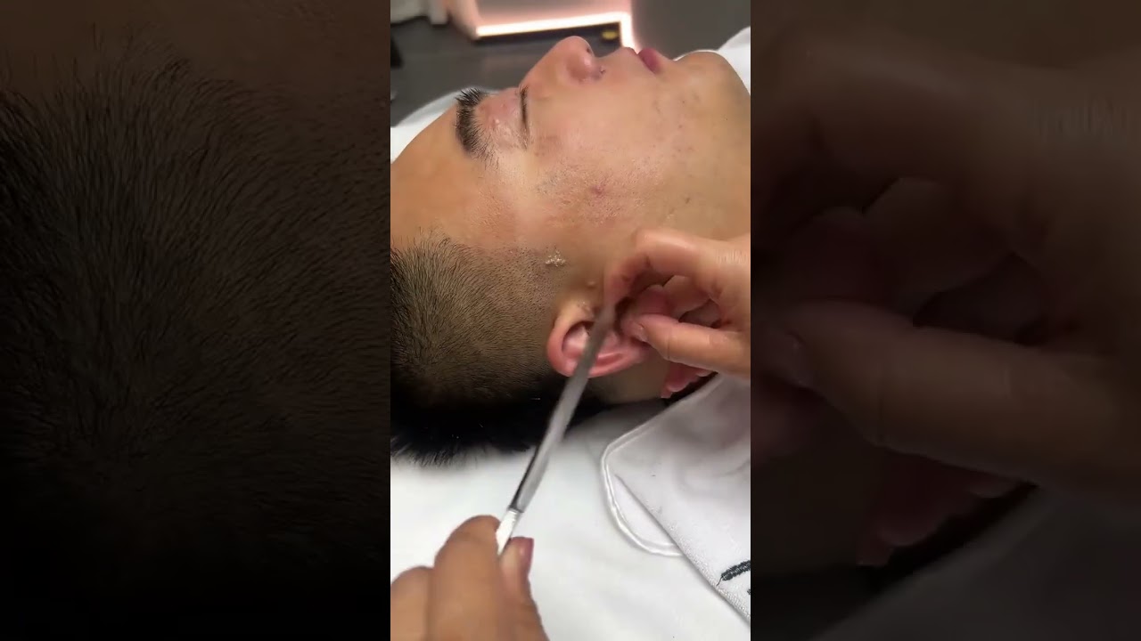💈Ear Shaving & Remove vellus hair #skincare #relax