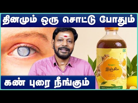 கண்புரை குணமாக | eye cataract treatment without surgery | Mayan Senthil Kumar | Cosmo Health