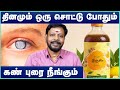 கண்புரை குணமாக Eye Cataract Treatment Without Surgery Mayan Senthil Kumar 