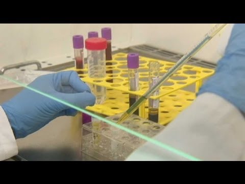 Trattamento ad alcolismo 4 stadi Quanti è necessario durante tempo per recuperare di un organismo da alcolismo
