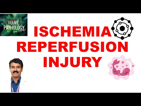 Ischemic heart disease  | part 4  | ISCHEMIA REPERFUSION INJURY | Pathogenesis | Prevention