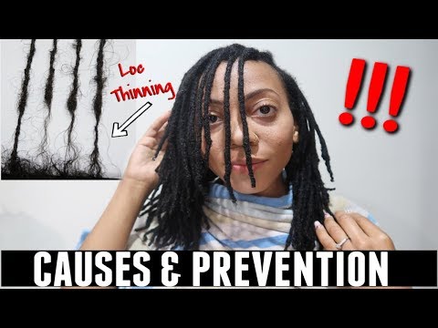 download lagu mp3 mp4 Locs Thinning At Ends, download lagu Locs Thinning At Ends gratis, unduh video klip Locs Thinning At Ends