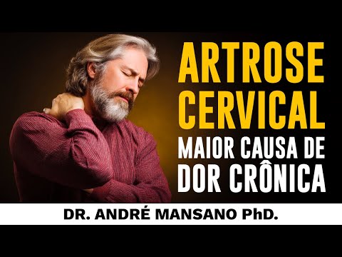 Cervical Osteoarthritis: The Most Common Cause of Chronic Neck Pain!