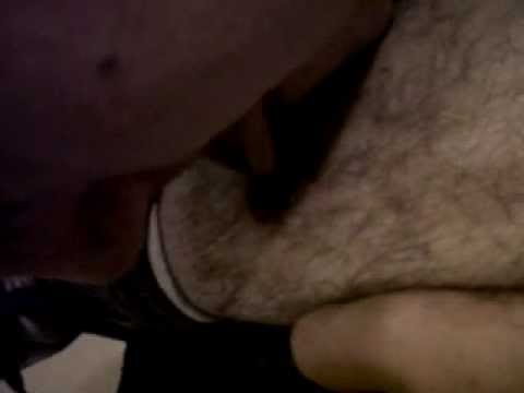 guy licks his infected leg DISGUSTING