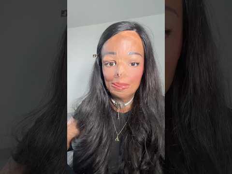 How I used to look before my accident 🤍