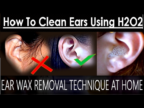 Ear Wax Removal Technique at Home | How To Clean Ears...
