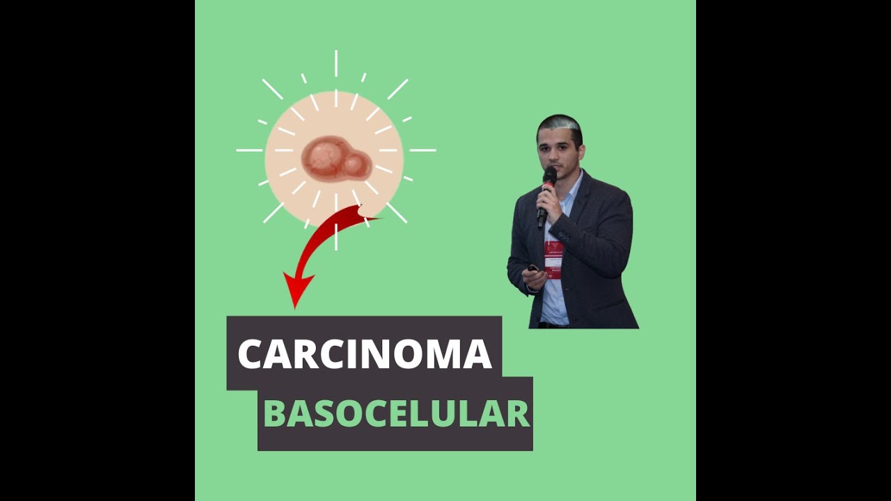 Carcinoma basocelular: o que você precisa saber!