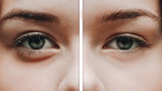 Reduce Dark Circles / Eye Bags | Photoshop