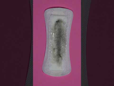 Why Is My Discharge Grey? Could It Be Bacterial Vaginosis (BV)?