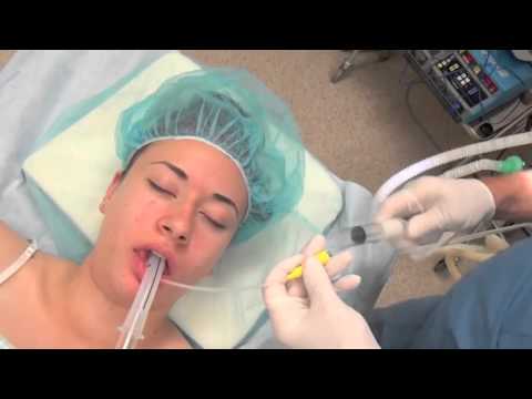 Vivir La Anestesia  -9 Narcosis Quirúrgico