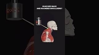 Improve Your Posture | Hunched Back Correction ✅ #shorts #posture #backpain #exercise #yoga