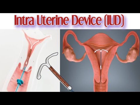 How Earphones and Earbuds Damaging Our Ear Are Earphones Harmful Hindi Urdu