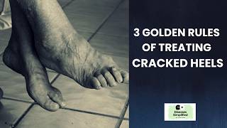 3 Golden Rules of Treating Cracked Heels