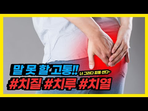헷갈리는 항문 질환! 치질, 치루, 치열 어떻게 다를까?