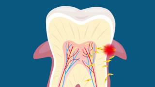 Chew on this: your teeth might be able to help grow new tissues