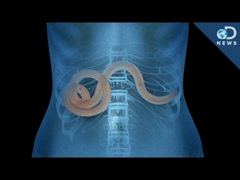 Sgomberiamo un organismo di parassiti per leggere Come uccidere tutti i vermi in intestini