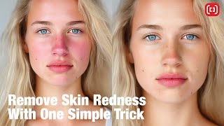 Photoshop Quickies: Removing Skin Redness (Easily!)