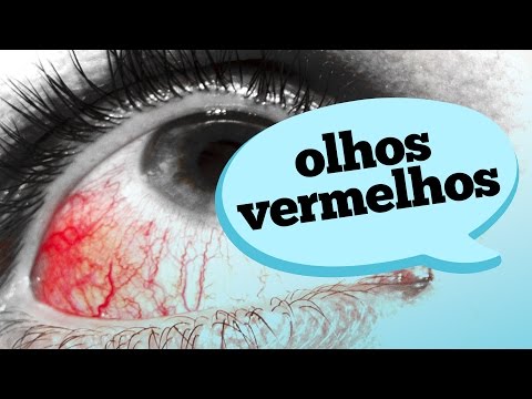 WHAT CAUSES RED EYES?