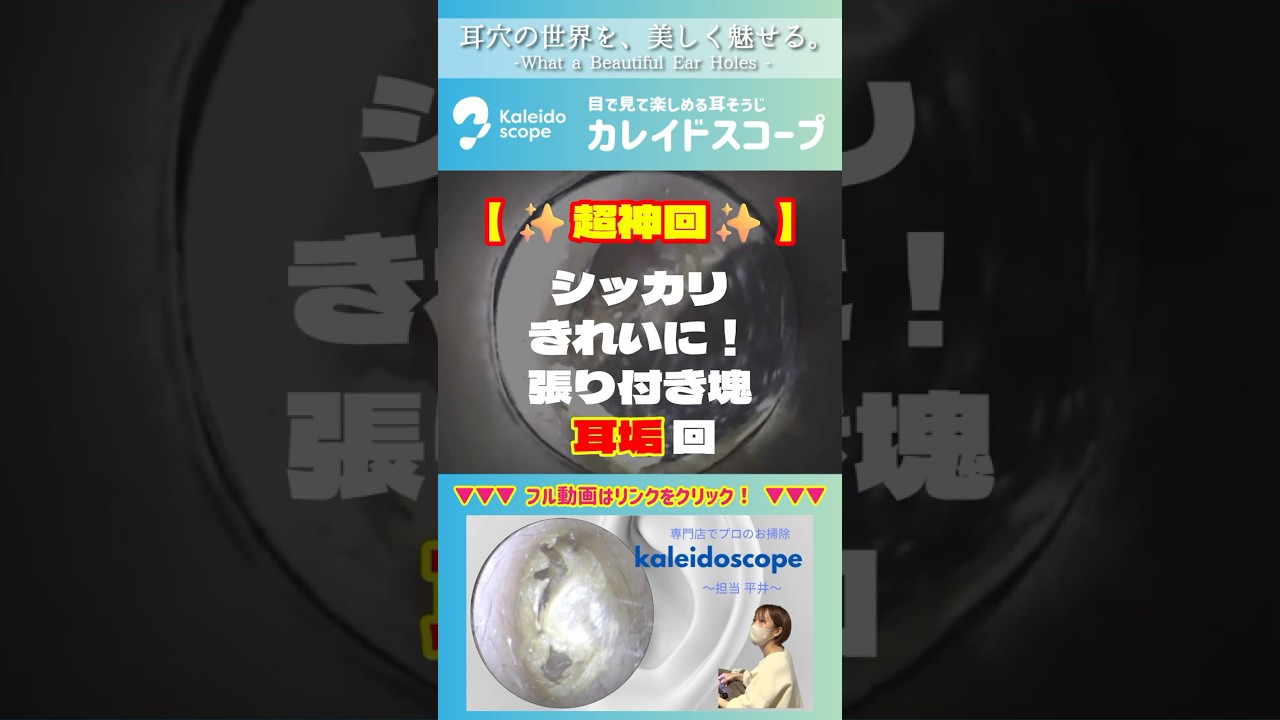 【超神回】シッカリきれいに！張り付き塊耳垢回