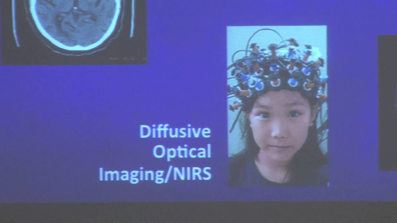 A Look Inside the Human Brain