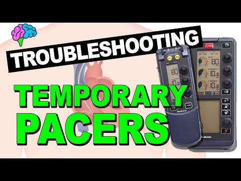 Troubleshooting Pacemaker Problems EXPLAINED!