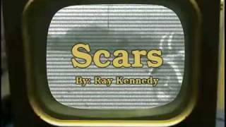 SCARS - RAY KENNEDY