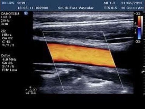 Color Box adjustment