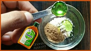 1 दिन में पुराने से पुराने दाद, खाज, खुजली, को खत्म कर देगा यह भयंकर नुस्खा//Fast Ringworm Solution