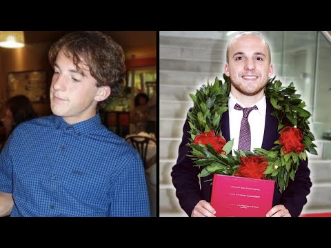 "I DON'T MISS MY HAIR" - Peter's story