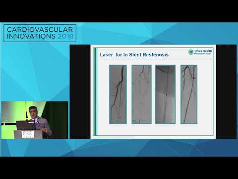 CVI2018 Session: Why I use atherectomy and what device? - Tony Das, MD