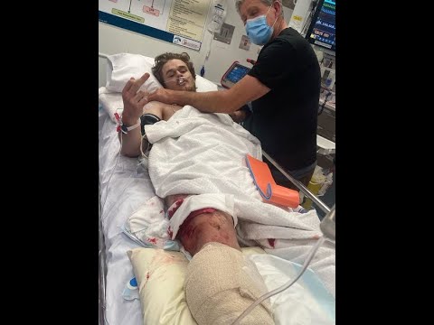 Amputee phantom pain