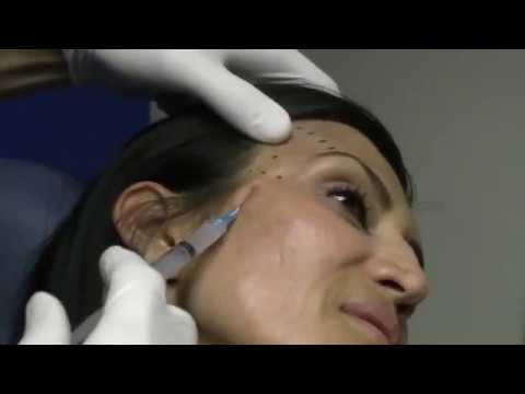 Temple Injections can help with signs of aging