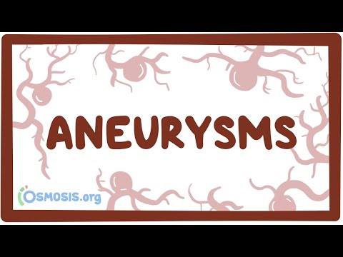 Aneurysms - causes, symptoms, diagnosis, treatment, pathology